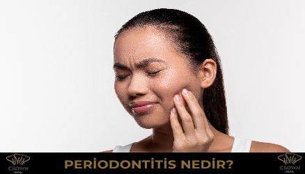 Periodontitis Nedir?