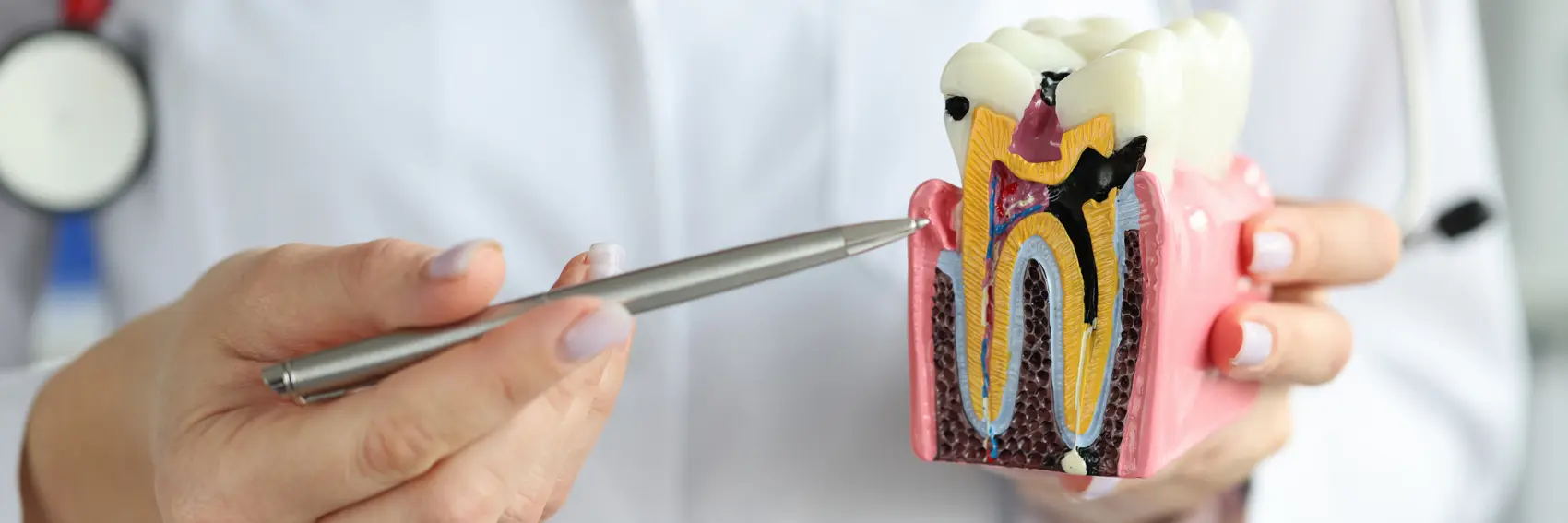 Periodontoloji (Diş Eti Hastalıkları)