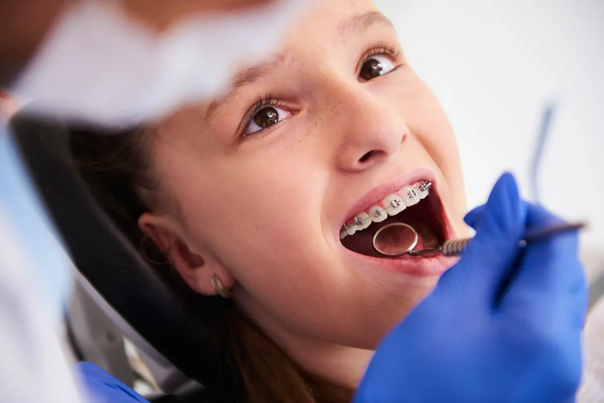 Ortodonti Nedir?