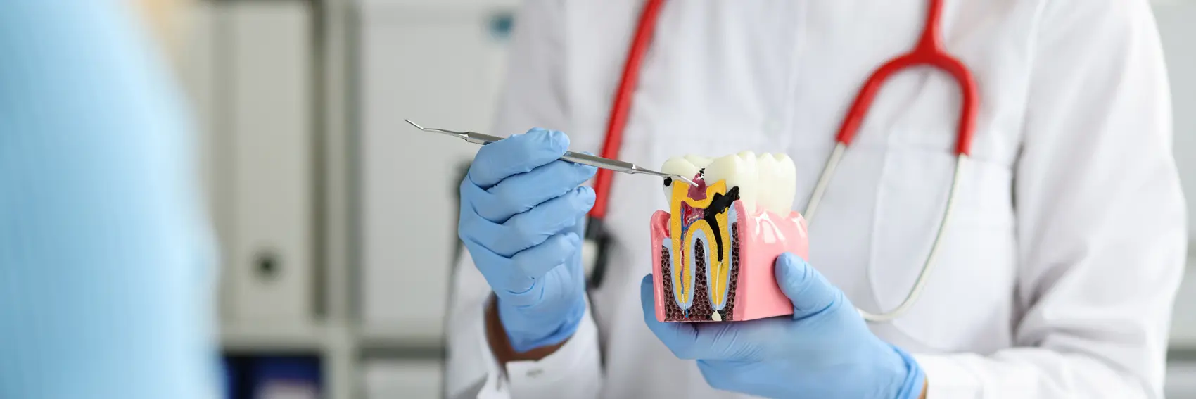 Endodonti (Kanal Tedavisi)
