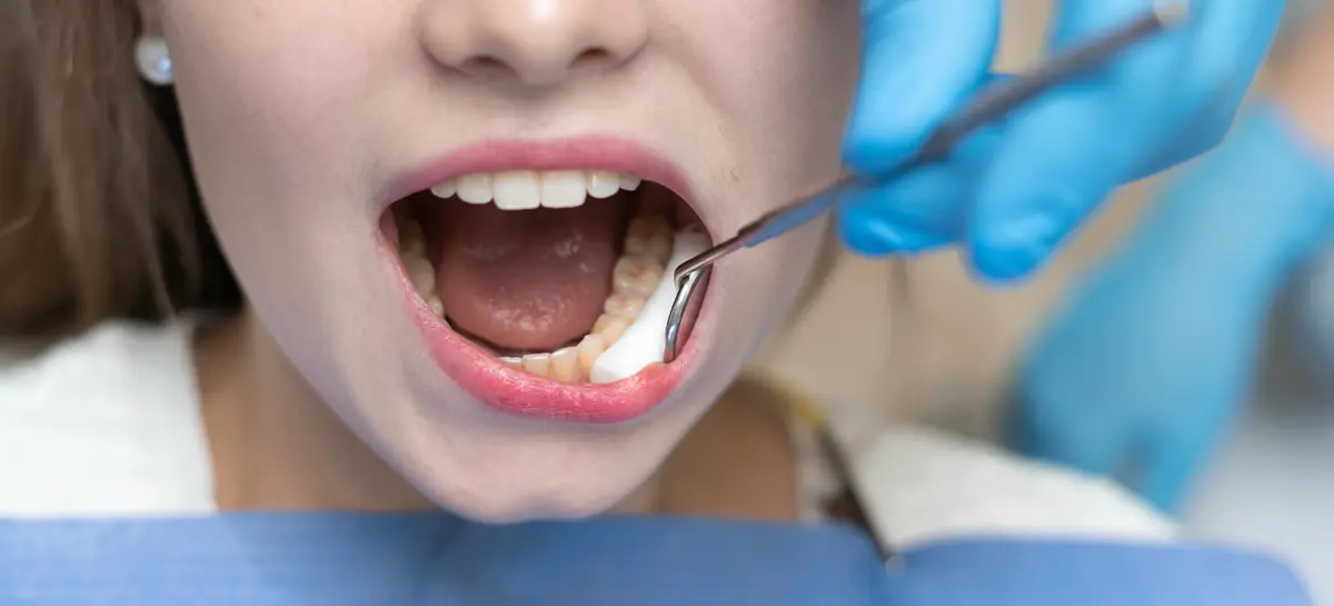 Periodontoloji Nedir